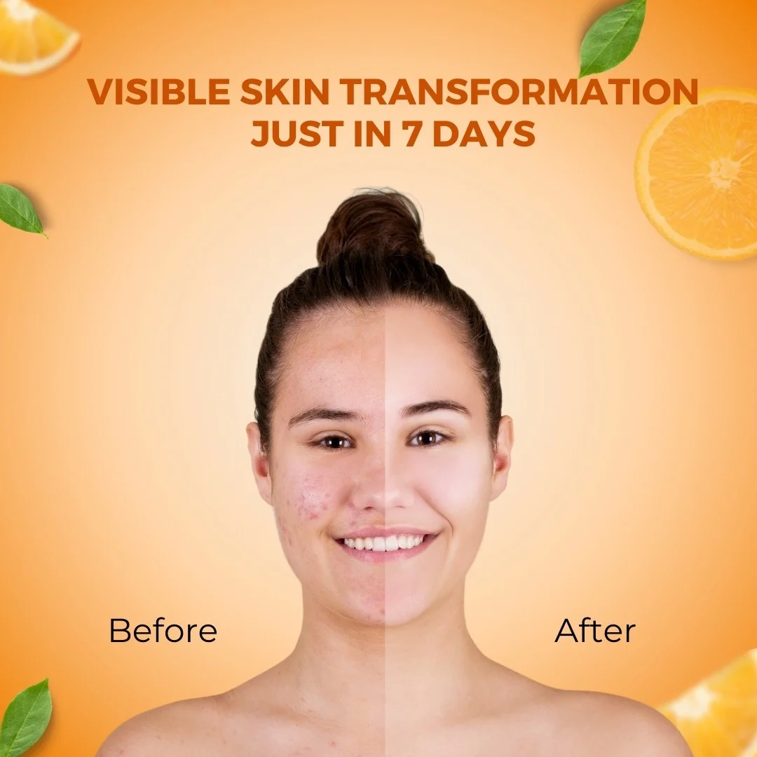 The Power of Vitamin C Face Serum: Hydration, Glow & Oil Control in One